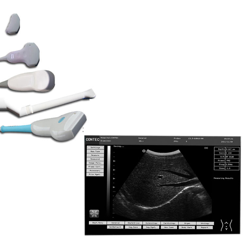 Sistema diagnostico veterinario ad ultrasuoni CMS600P2VET